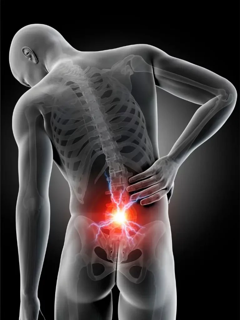 Ayurvedic treatment for back pain